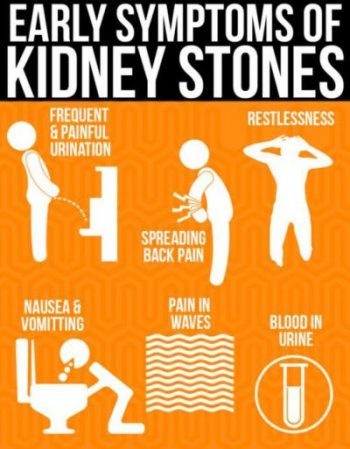 early symptoms of kidney stones