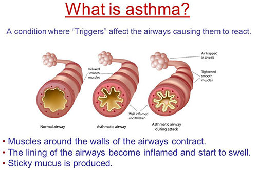 what does an asthma attack feel like