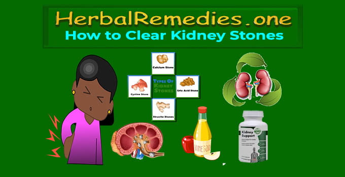 get rid of kidney stones
